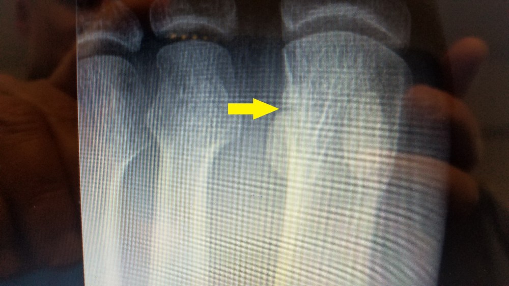 20170411_093021 - Copy